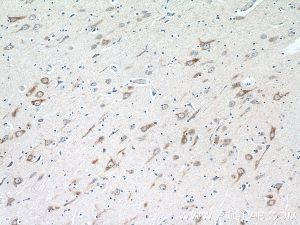 Immunohistochemistry (IHC) staining of human brain tissue using VGF Polyclonal antibody (26781-1-AP)