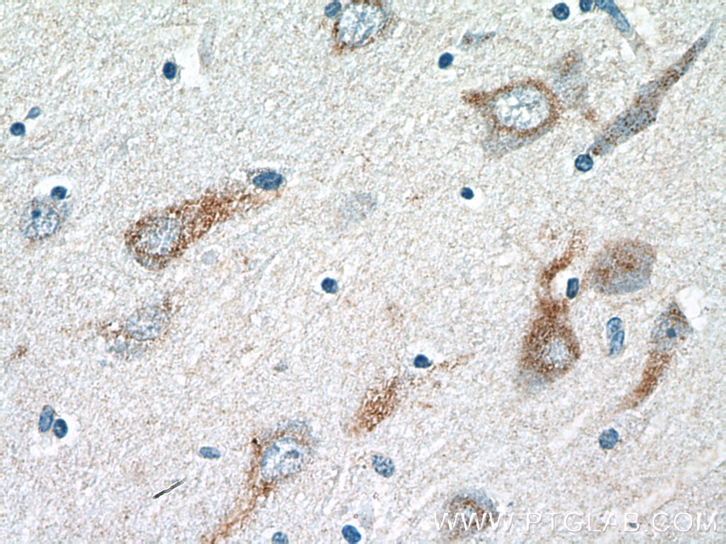Immunohistochemistry (IHC) staining of human brain tissue using VGF Polyclonal antibody (26781-1-AP)