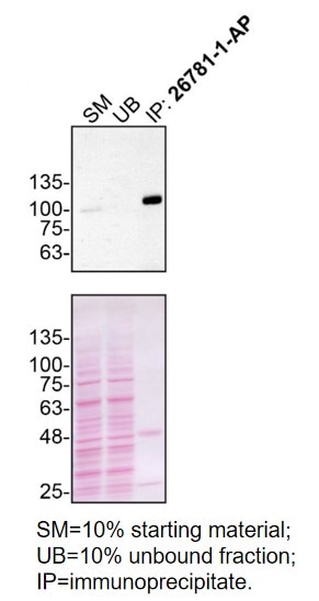 Immunoprecipitation (IP) experiment of U2OS cells using VGF Polyclonal antibody (26781-1-AP)