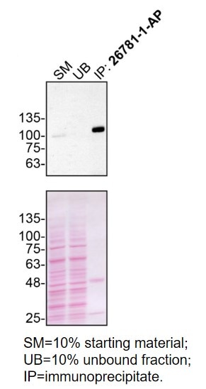 IP experiment of U2OS using 26781-1-AP