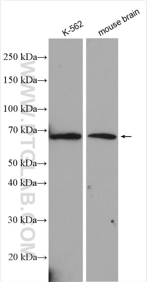 Western Blot (WB) analysis of various lysates using VGF Polyclonal antibody (26781-1-AP)