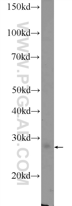 WB analysis of rat brain using 10124-2-AP