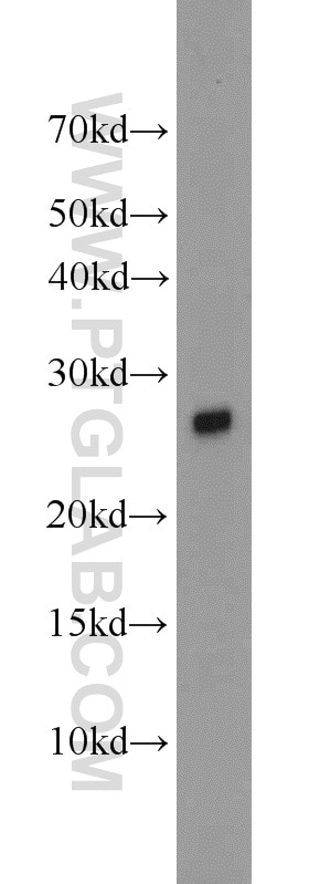 Western Blot (WB) analysis of human brain tissue using VGLL1 Polyclonal antibody (10124-2-AP)