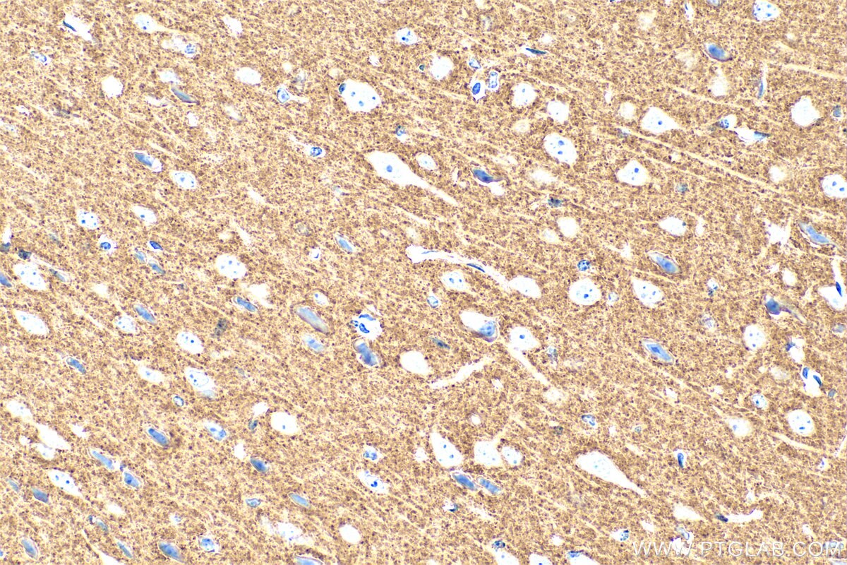 Immunohistochemistry (IHC) staining of mouse brain tissue using VGLUT1 Polyclonal antibody (29469-1-AP)