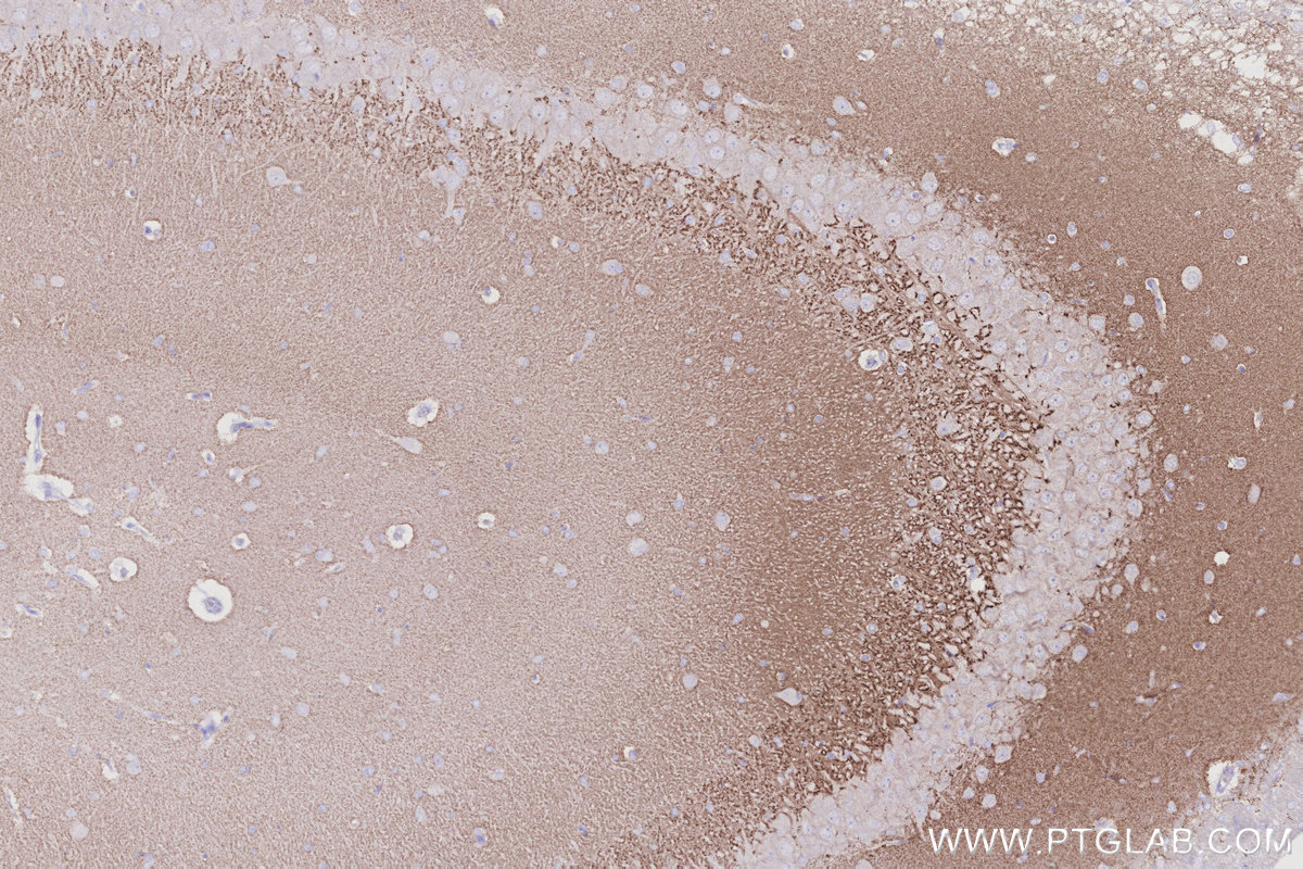 IHC staining of rat brain using 29469-1-AP Immunohistochemistry (IHC) staining of rat brain tissue using VGLUT1 Polyclonal antibody (29469-1-AP)