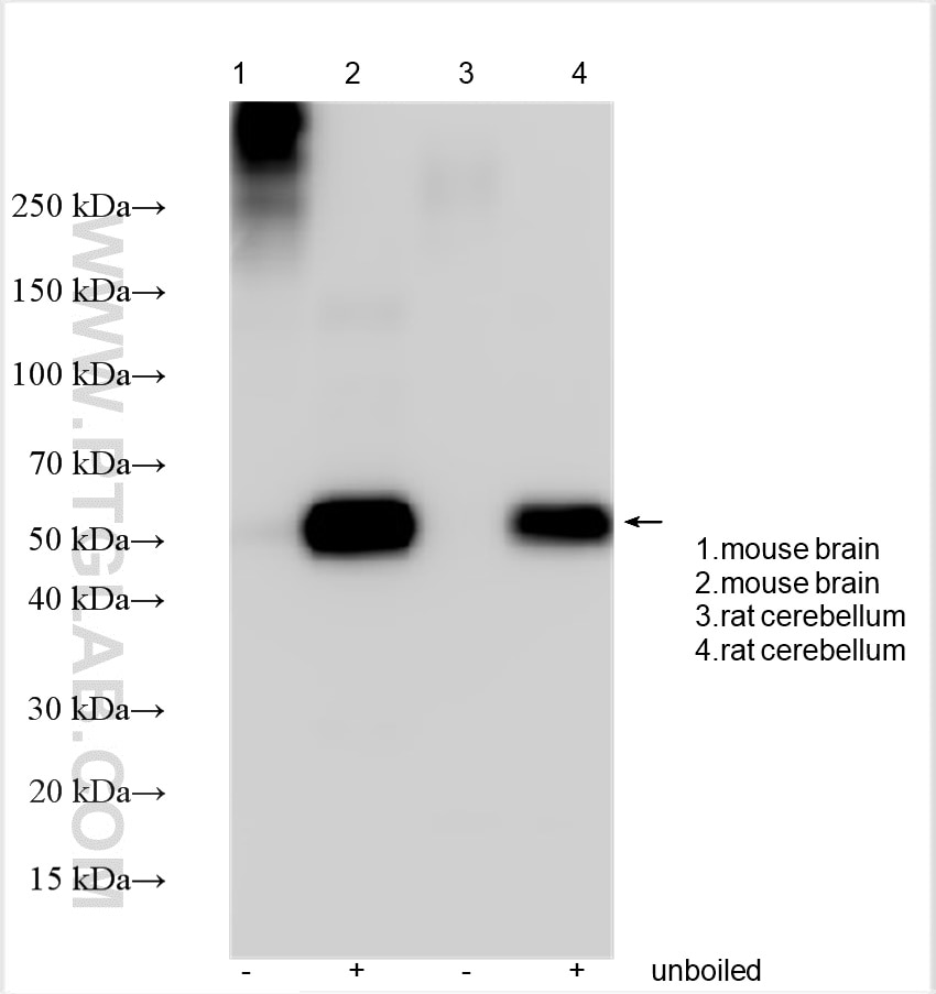 Western Blot (WB) analysis of mouse brain tissue using VGLUT1 Polyclonal antibody (29469-1-AP)