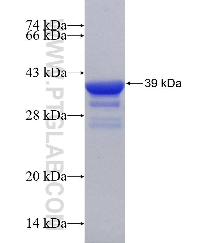 VGLUT1 fusion protein Ag31193 SDS-PAGE