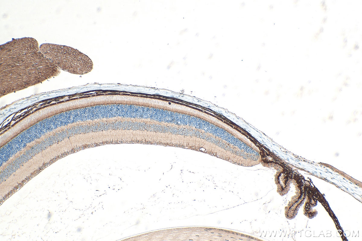 Immunohistochemical analysis of paraffin-embedded mouse eye tissue slide using 25261-1-AP (VGLUT2 antibody) at dilution of 1:400 (under 10x lens). Heat mediated antigen retrieval with Tris-EDTA buffer (pH 9.0). Immunohistochemistry (IHC) staining of mouse eye tissue using VGLUT2 Polyclonal antibody (25261-1-AP)