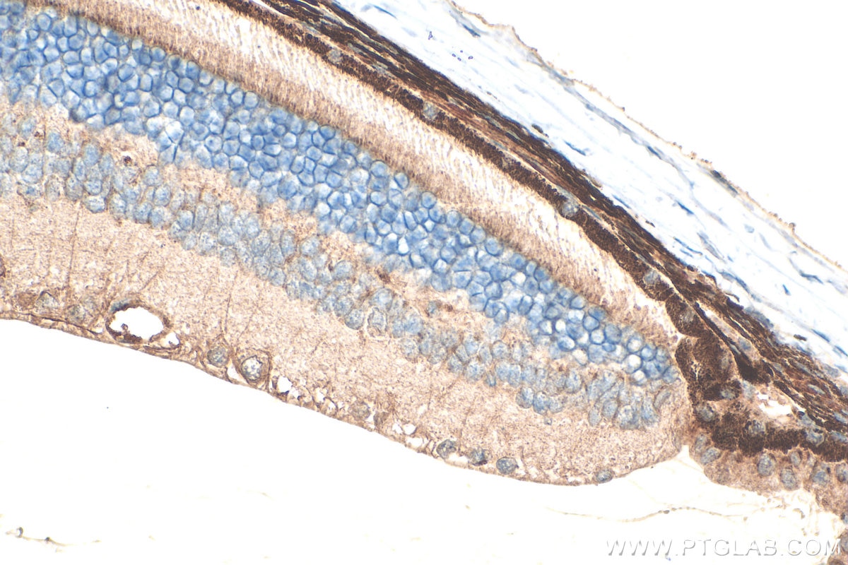 Immunohistochemical analysis of paraffin-embedded mouse eye tissue slide using 25261-1-AP (VGLUT2 antibody) at dilution of 1:400 (under 40x lens). Heat mediated antigen retrieval with Tris-EDTA buffer (pH 9.0). Immunohistochemistry (IHC) staining of mouse eye tissue using VGLUT2 Polyclonal antibody (25261-1-AP)