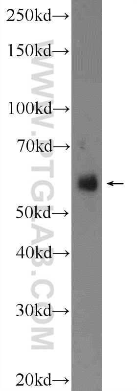 Western Blot (WB) analysis of fetal human brain tissue using VGLUT2 Polyclonal antibody (25261-1-AP)