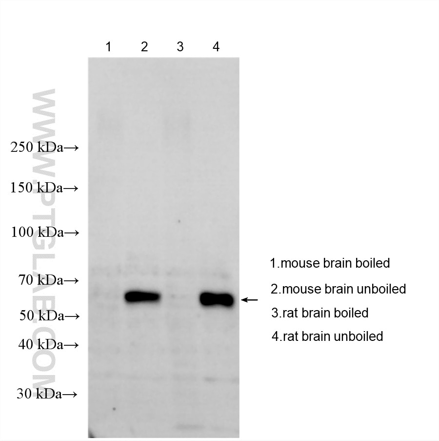 WB analysis using 25261-1-AP Western Blot (WB) analysis of various lysates using VGLUT2 Polyclonal antibody (25261-1-AP)