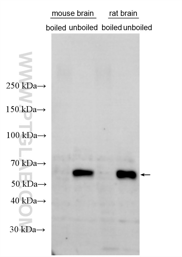 Western Blot (WB) analysis of various lysates using VGLUT2 Polyclonal antibody (25261-1-AP)