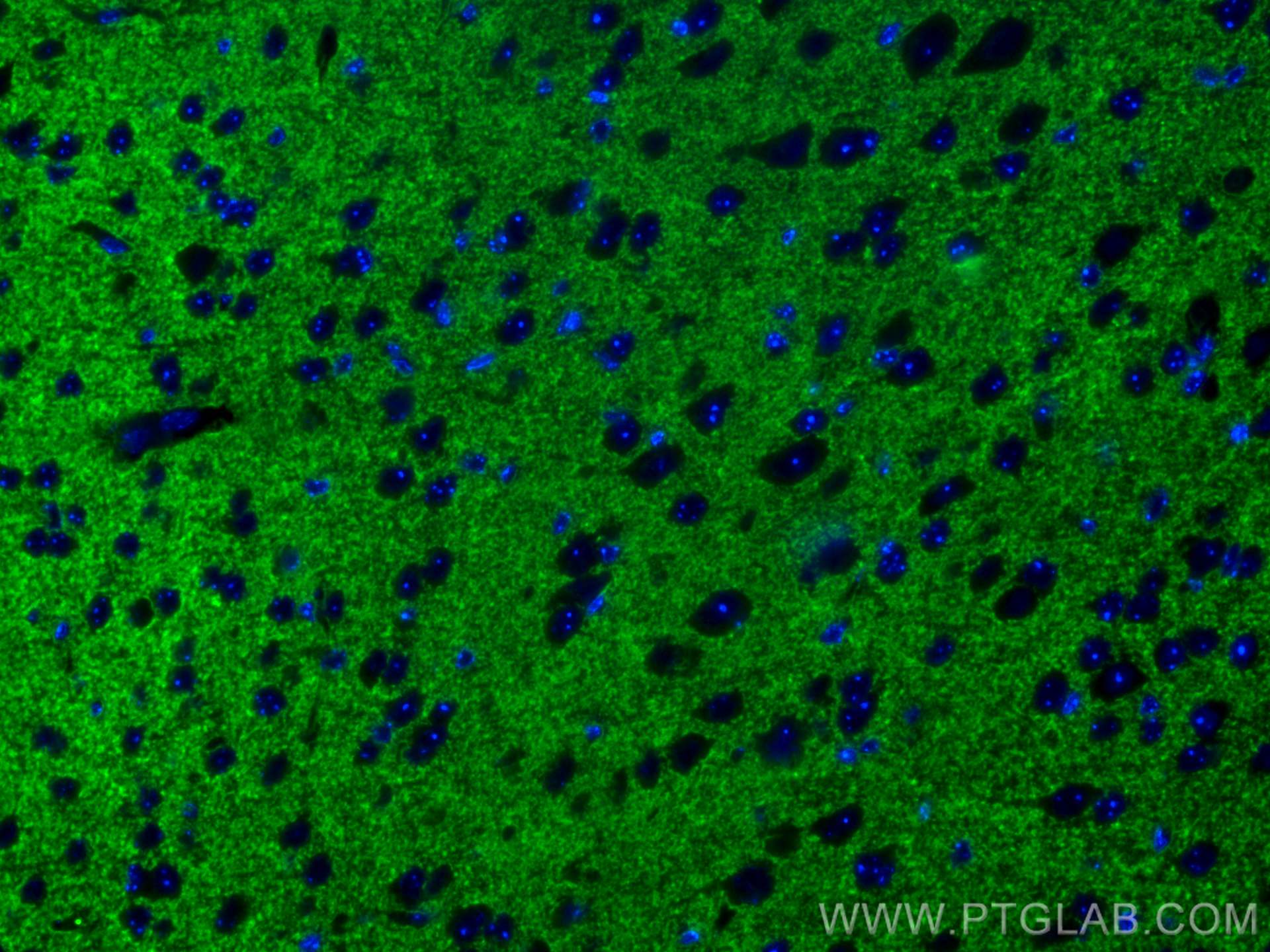 Immunofluorescence (IF) / fluorescent staining of mouse brain tissue using VGLUT2 Polyclonal antibody (29209-1-AP)