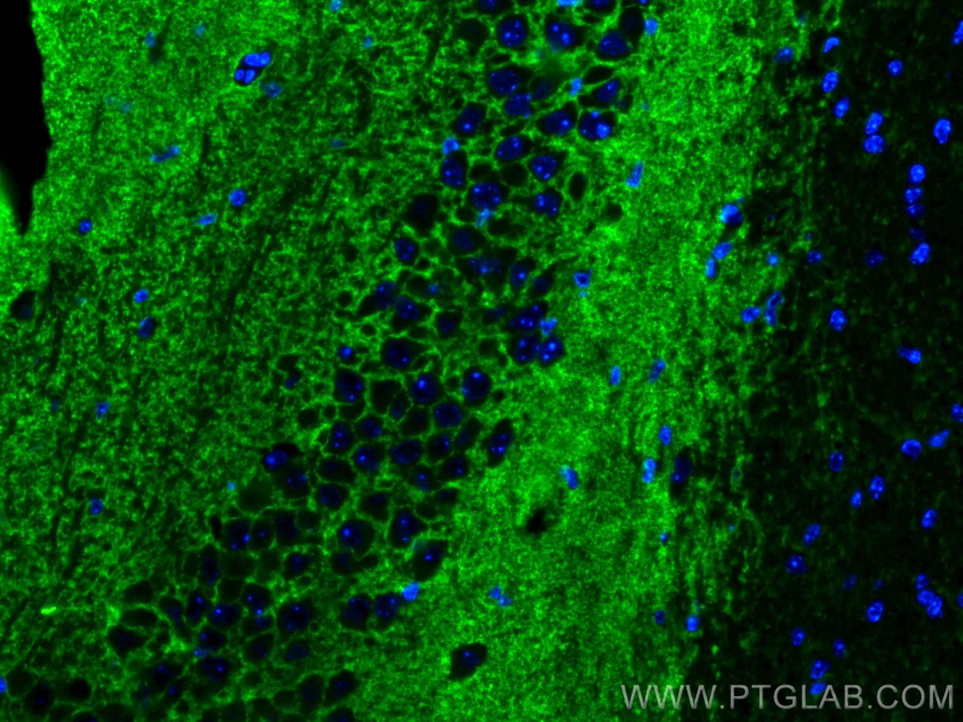 Immunofluorescence (IF) / fluorescent staining of mouse brain tissue using VGLUT2 Polyclonal antibody (29209-1-AP)