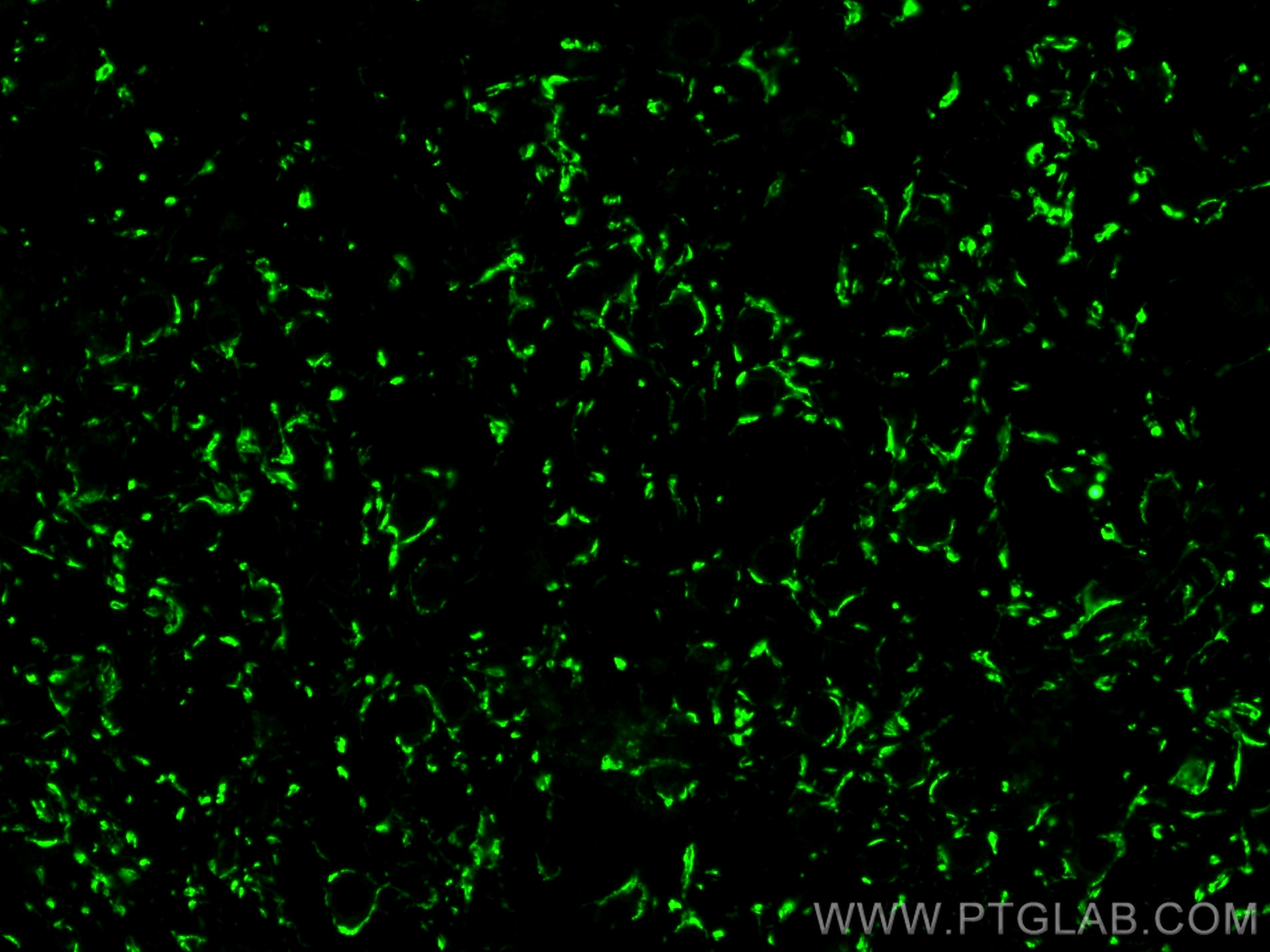 Immunofluorescence (IF) / fluorescent staining of mouse brain tissue using VGLUT2 Polyclonal antibody (29209-1-AP)