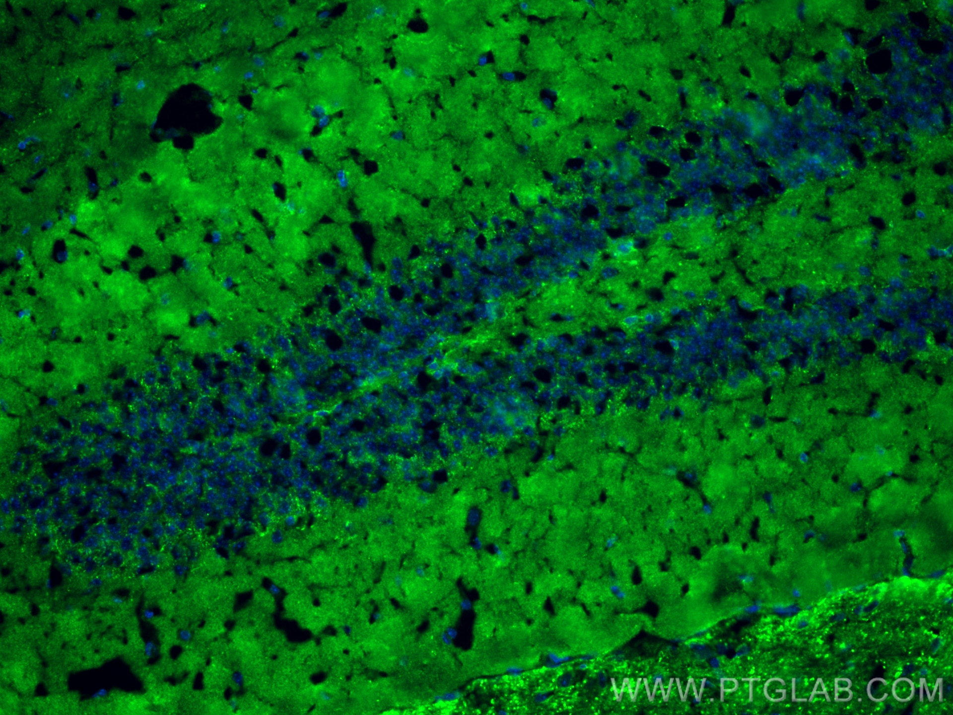 Immunofluorescence (IF) / fluorescent staining of mouse brain tissue using VGLUT2 Polyclonal antibody (29209-1-AP)