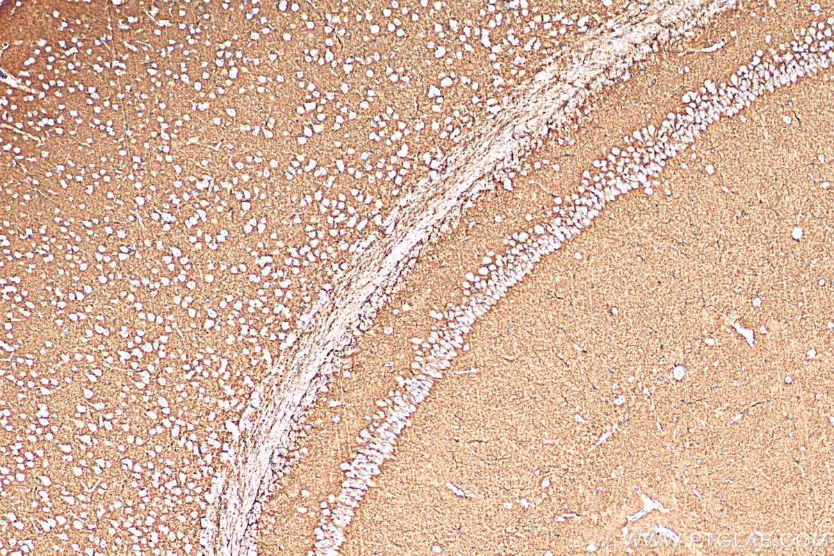 Immunohistochemistry (IHC) staining of mouse brain tissue using VGLUT2 Polyclonal antibody (29209-1-AP)