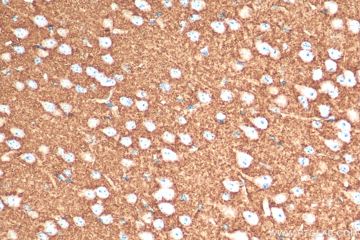 Immunohistochemistry (IHC) staining of mouse brain tissue using VGLUT2 Polyclonal antibody (29209-1-AP)