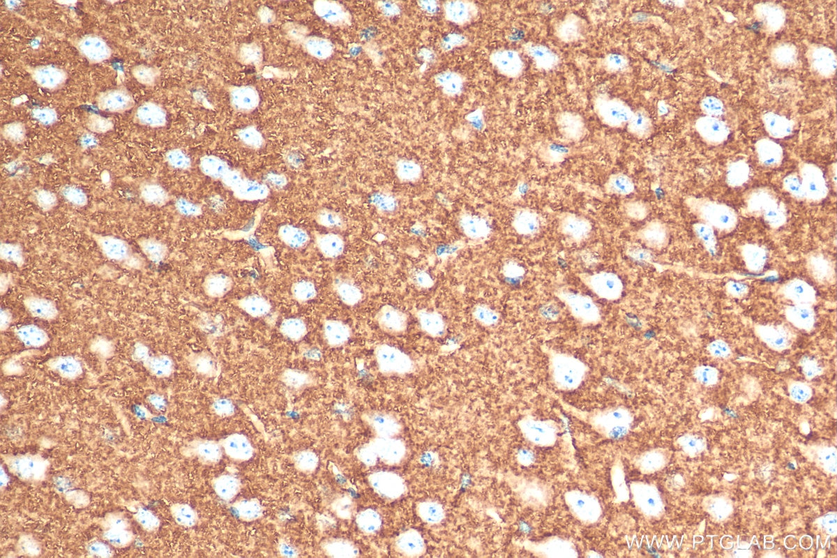 IHC staining of mouse brain using 29209-1-AP