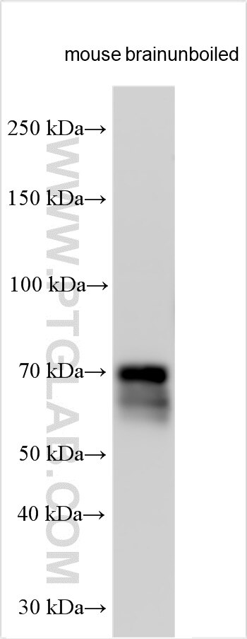 Western Blot (WB) analysis of various lysates using VGLUT2 Polyclonal antibody (29209-1-AP)