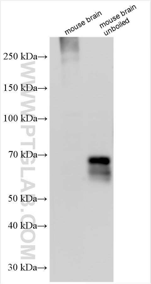 Western Blot (WB) analysis of various lysates using VGLUT2 Polyclonal antibody (29209-1-AP)