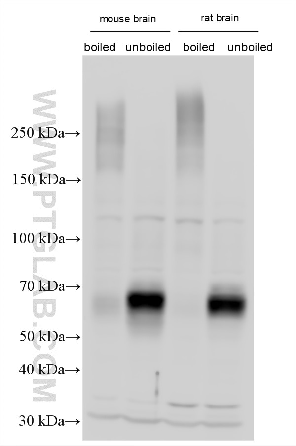WB analysis using 29209-1-AP Western Blot (WB) analysis of various lysates using VGLUT2 Polyclonal antibody (29209-1-AP)