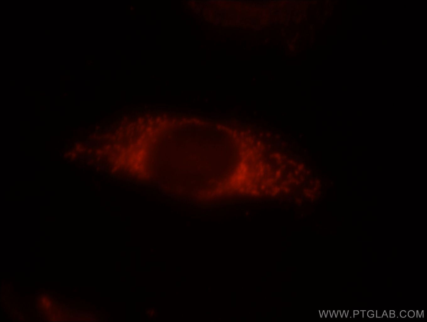 Immunofluorescence (IF) / fluorescent staining of HepG2 cells using VHL Polyclonal antibody (16538-1-AP)