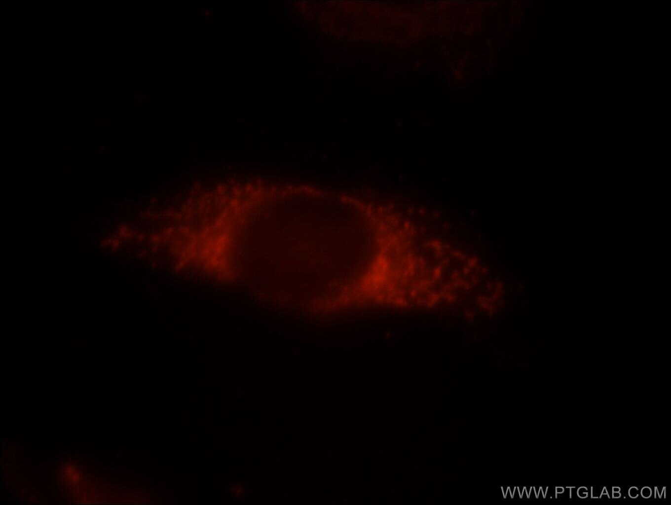 Immunofluorescence (IF) / fluorescent staining of HepG2 cells using VHL Polyclonal antibody (16538-1-AP)