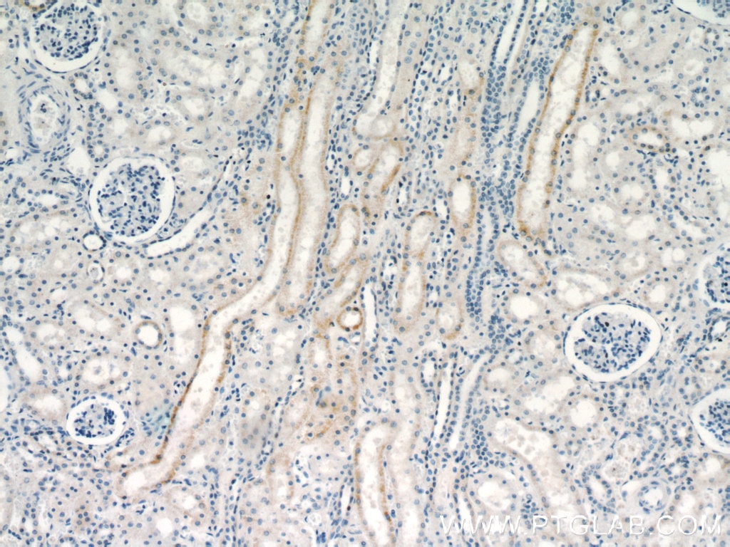 Immunohistochemistry (IHC) staining of human kidney tissue using VHL Polyclonal antibody (16538-1-AP)