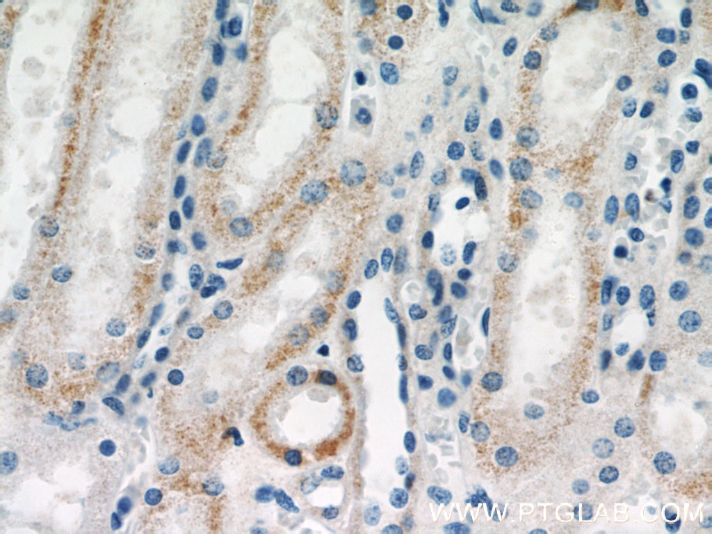 Immunohistochemistry (IHC) staining of human kidney tissue using VHL Polyclonal antibody (16538-1-AP)