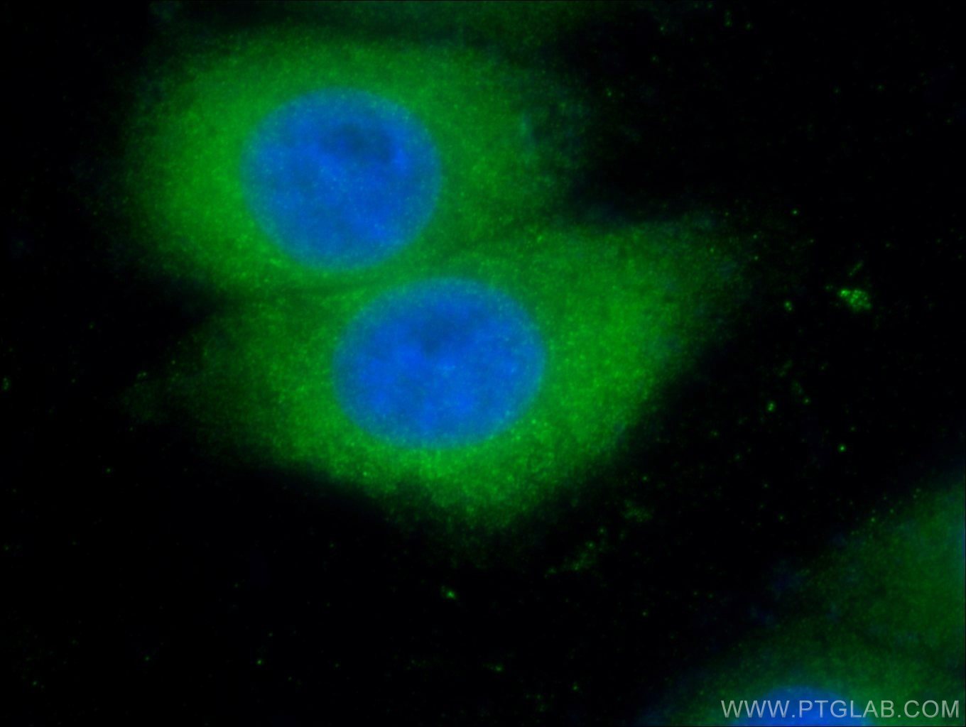 Immunofluorescence (IF) / fluorescent staining of HepG2 cells using VHL Polyclonal antibody (24756-1-AP)