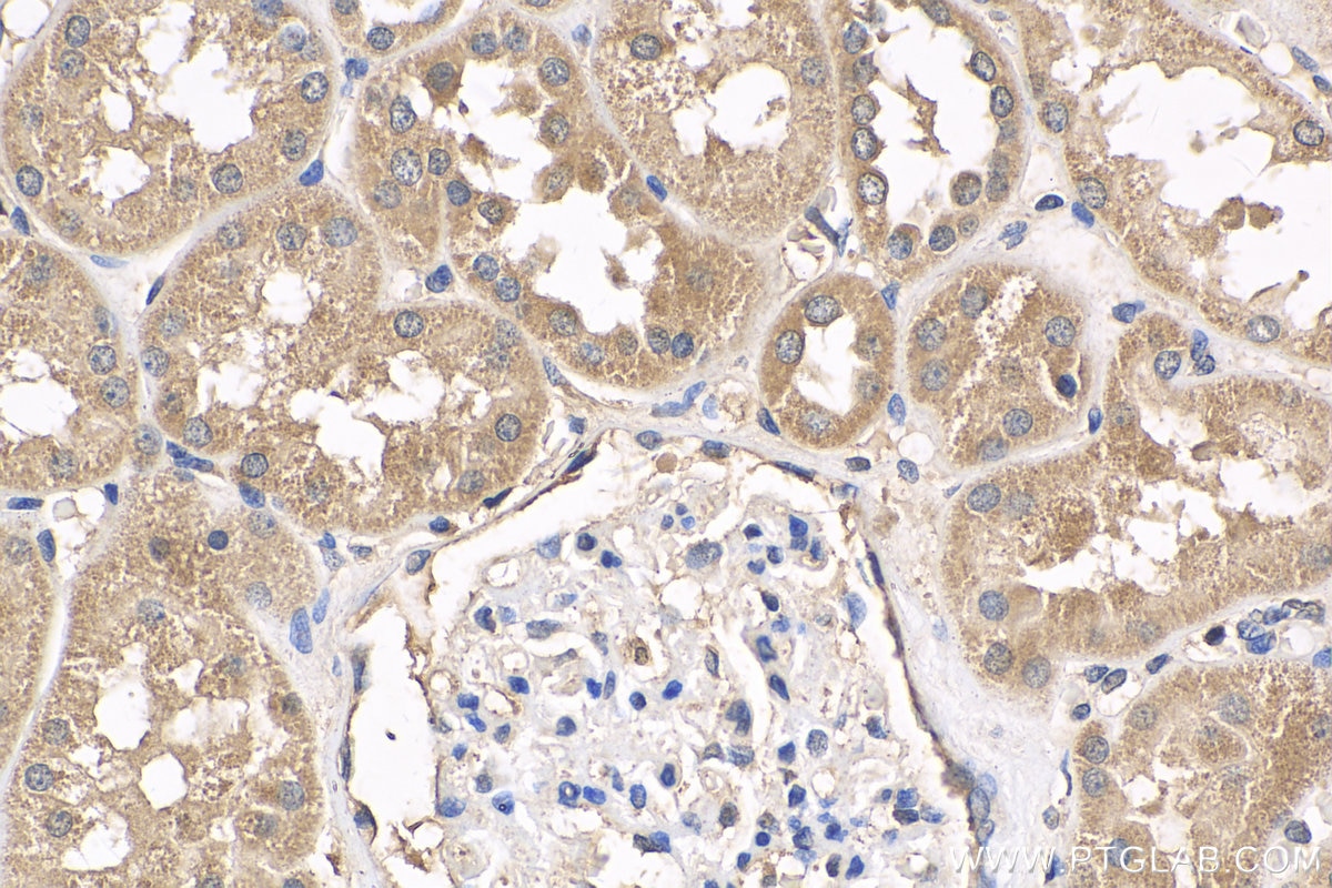 Immunohistochemistry (IHC) staining of human kidney tissue using VHL Polyclonal antibody (24756-1-AP)