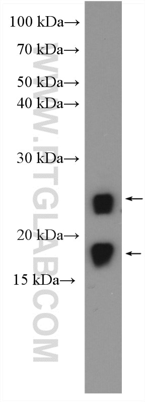 Western Blot (WB) analysis of Jurkat cells using VHL Polyclonal antibody (24756-1-AP)