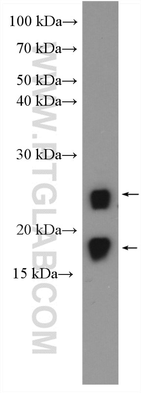 WB analysis of Jurkat using 24756-1-AP