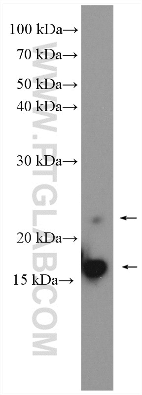 Western Blot (WB) analysis of HeLa cells using VHL Polyclonal antibody (24756-1-AP)