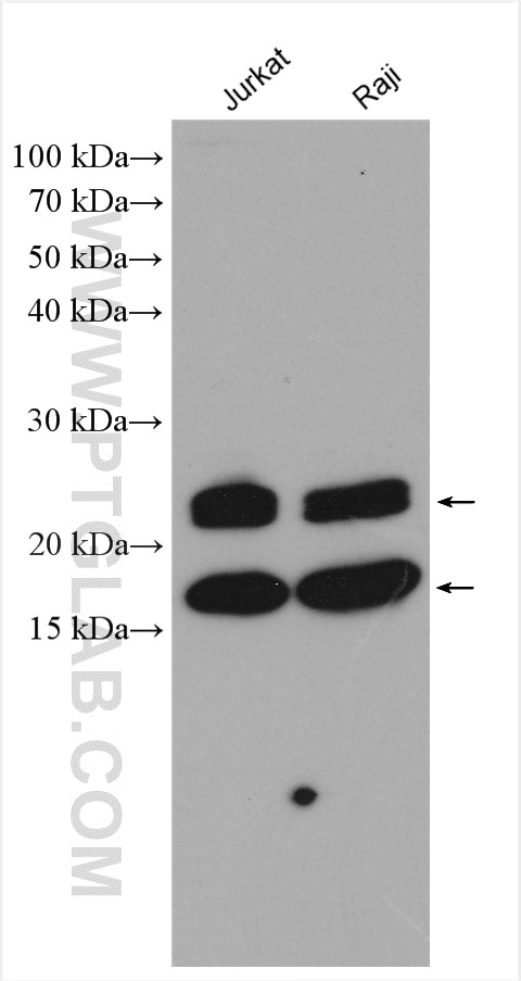 Western Blot (WB) analysis of various lysates using VHL Polyclonal antibody (24756-1-AP)