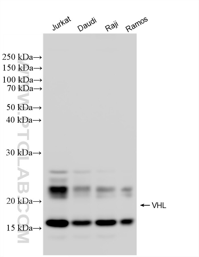 Western Blot (WB) analysis of various lysates using VHL Recombinant monoclonal antibody (87374-1-RR)