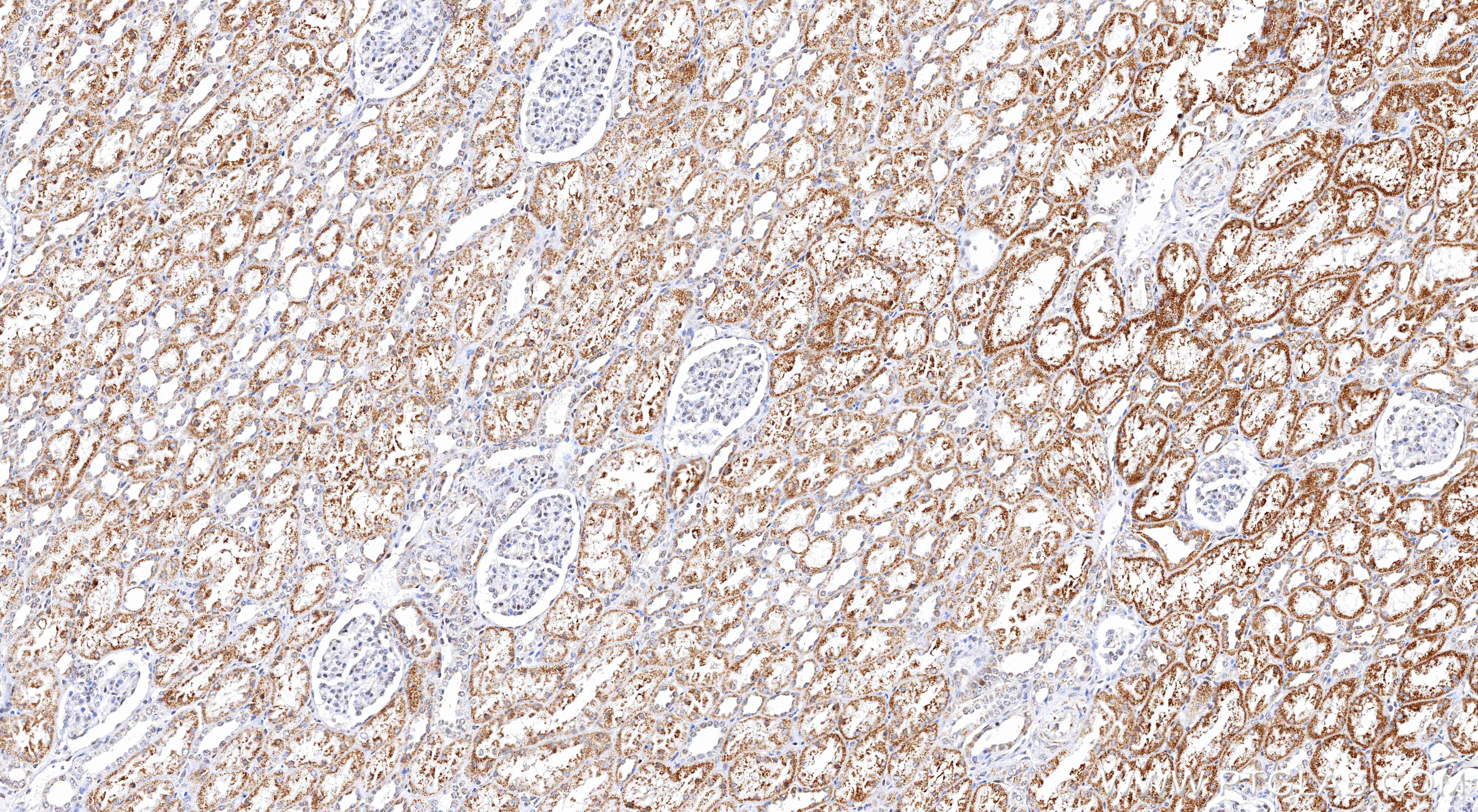 Immunohistochemistry (IHC) staining of human kidney tissue using VHL Recombinant monoclonal antibody (87374-3-RR)