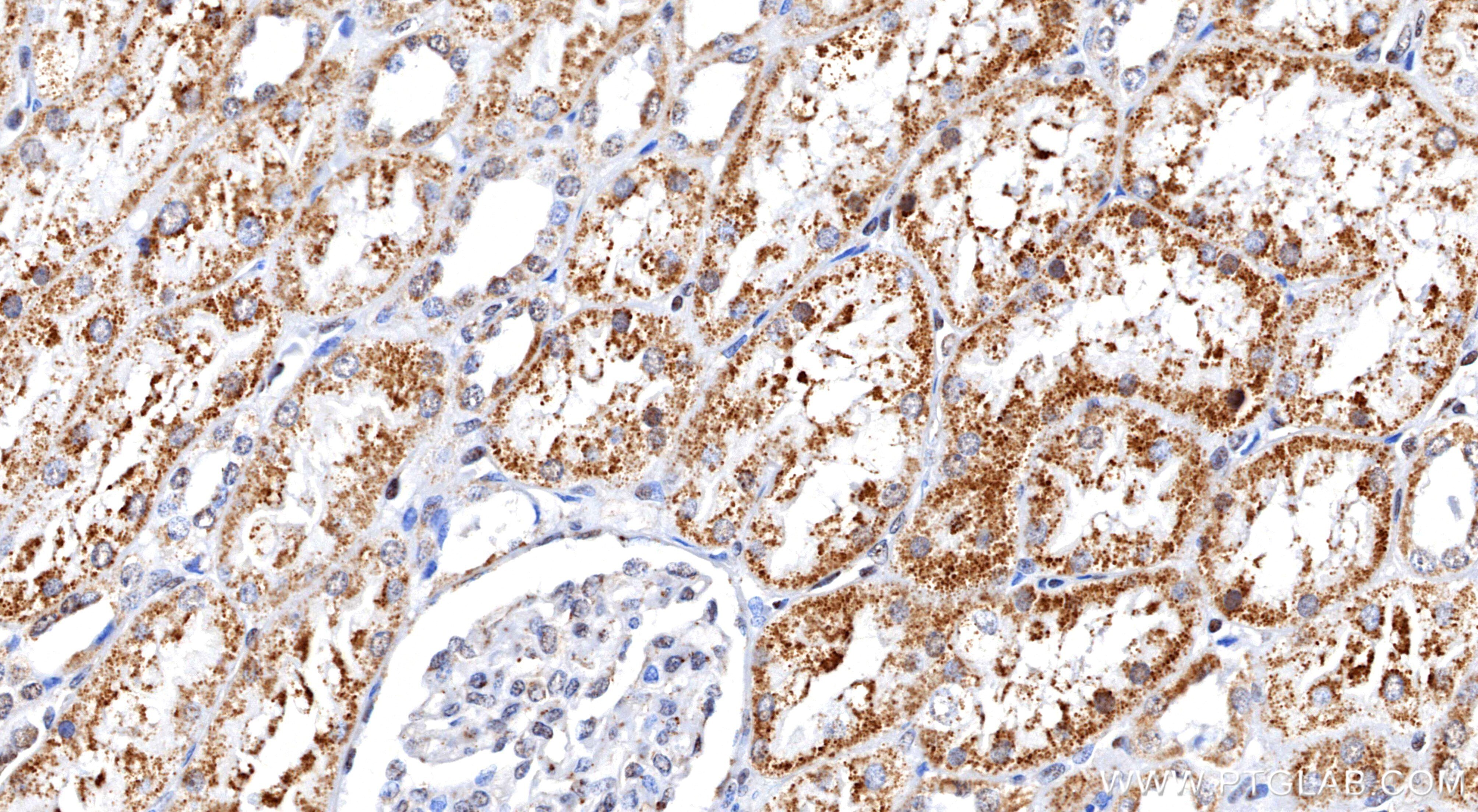 Immunohistochemistry (IHC) staining of human kidney tissue using VHL Recombinant monoclonal antibody (87374-3-RR)
