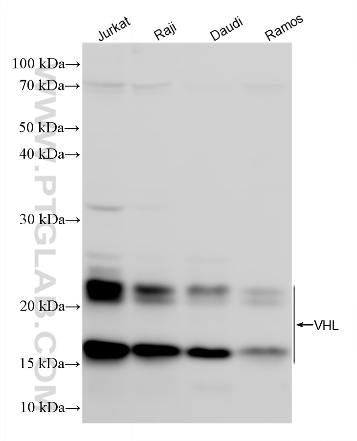 WB analysis using 87374-3-RR (same clone as 87374-3-PBS) Western Blot (WB) analysis of various lysates using VHL Recombinant monoclonal antibody (87374-3-RR)