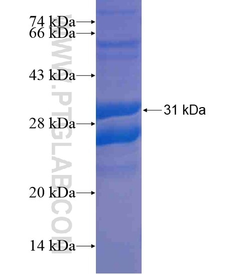 VHL fusion protein Ag21447 SDS-PAGE