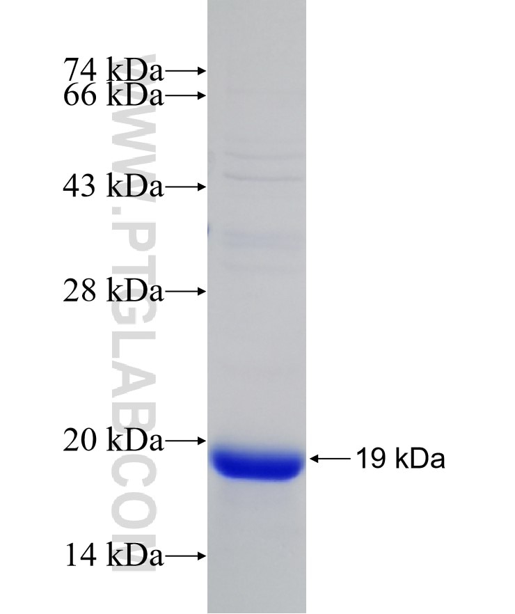 VHL fusion protein Ag21455 SDS-PAGE