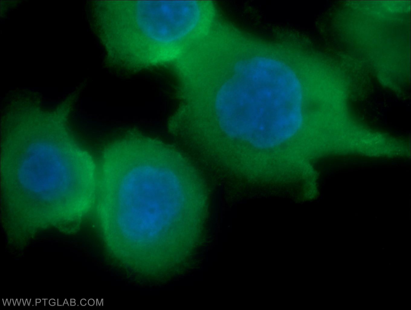 Immunofluorescence (IF) / fluorescent staining of COLO 320 cells using Villin Polyclonal antibody (16488-1-AP)
