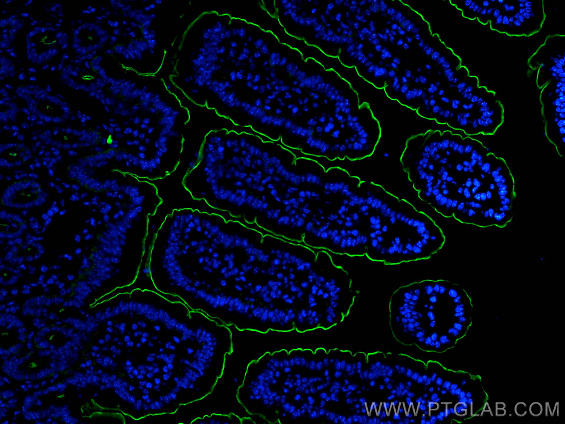 Immunofluorescence (IF) / fluorescent staining of mouse small intestine tissue using Villin Polyclonal antibody (16488-1-AP)