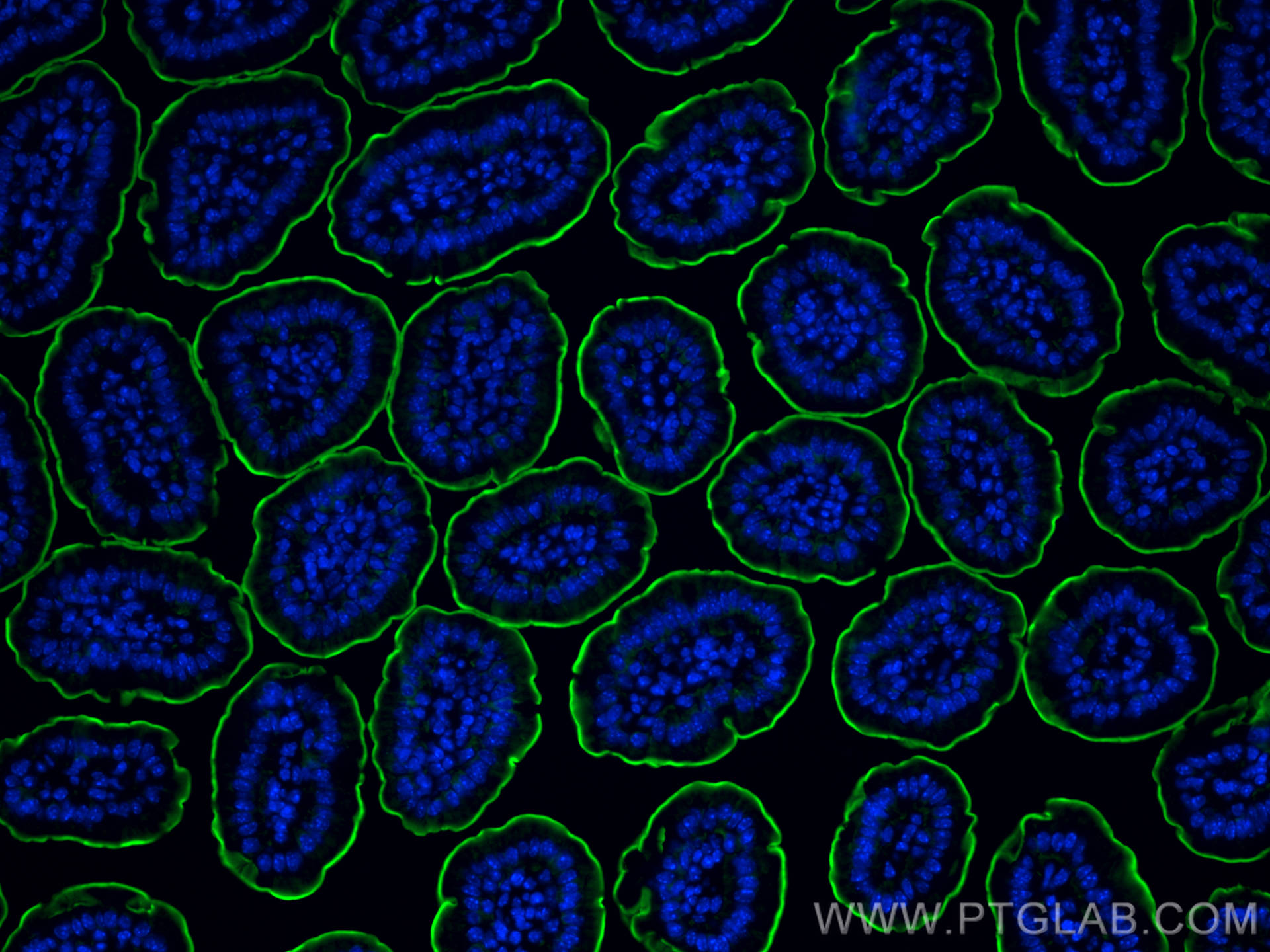 Immunofluorescence (IF) / fluorescent staining of mouse small intestine tissue using Villin Polyclonal antibody (16488-1-AP)