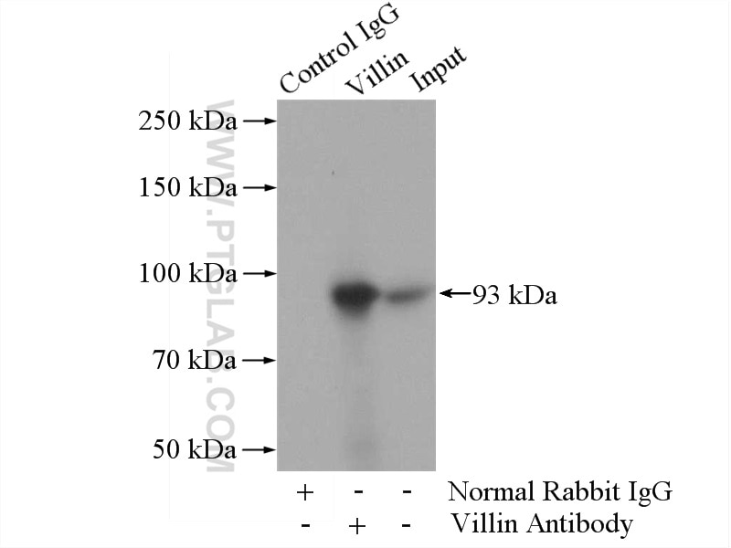 Immunoprecipitation (IP) experiment of mouse kidney tissue using Villin Polyclonal antibody (16488-1-AP)