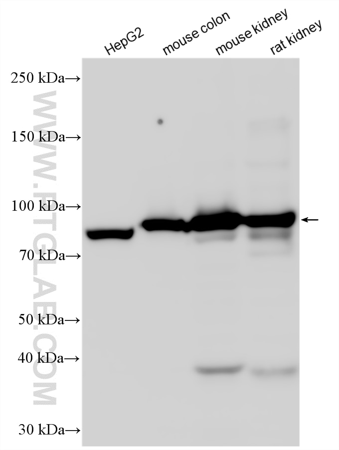 Western Blot (WB) analysis of various lysates using Villin Polyclonal antibody (16488-1-AP)