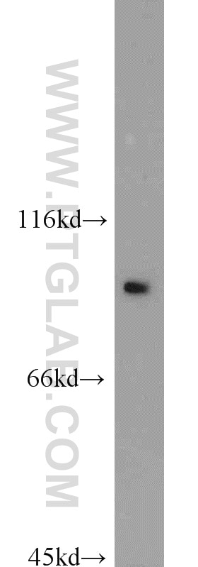 Western Blot (WB) analysis of mouse liver tissue using Villin Polyclonal antibody (16488-1-AP)