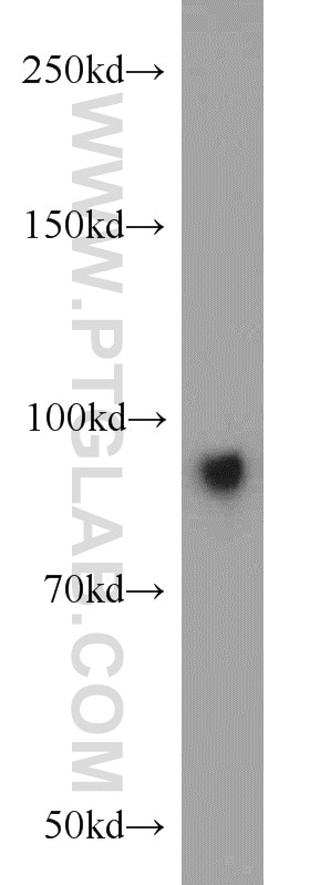 Western Blot (WB) analysis of mouse colon tissue using Villin Polyclonal antibody (16488-1-AP)