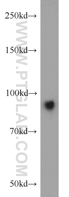 WB analysis of mouse colon using 16488-1-AP